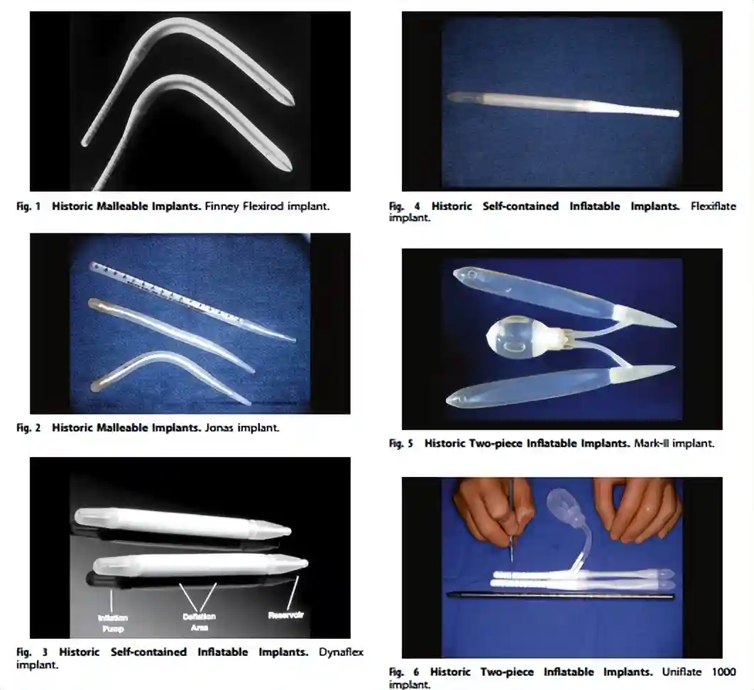 阴茎支撑体植入术进展：过去，现在，未来